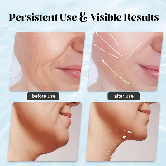 EMS Face Lifting Massager with Red Light Therapy | Facial, Neck & Eye Microcurrent Vibrating Massage Tool
