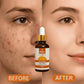 Relax Vitamin C Daily Serum - 30ml | Visibly Brightens, Evens Skin Tone